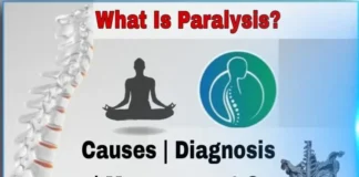 Paralysis : | लकवा | निदान | प्रबंधन | और रोकथाम Paralysis